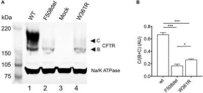 Functional and Pharmacological Characterization of the Rare CFTR Mutation W361R